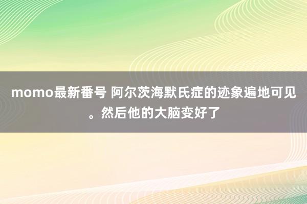 momo最新番号 阿尔茨海默氏症的迹象遍地可见。然后他的大脑变好了